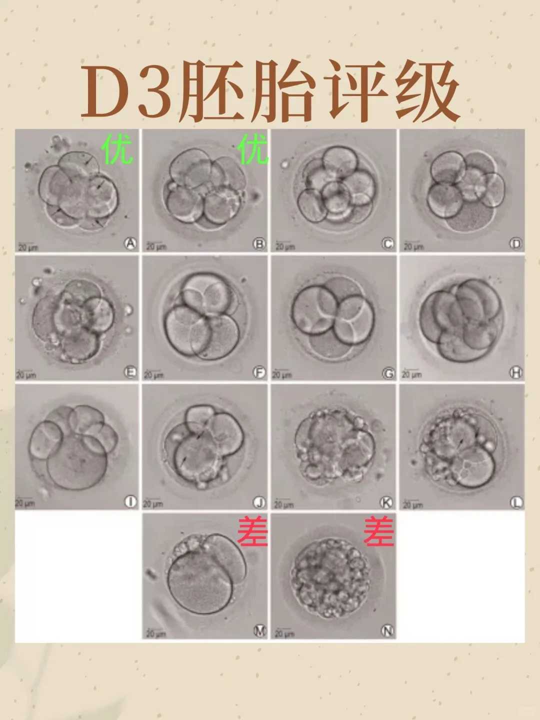 有代怀吗,捐卵代怀价格,生产后上环好还是不好呢？生产后多久上环合适？